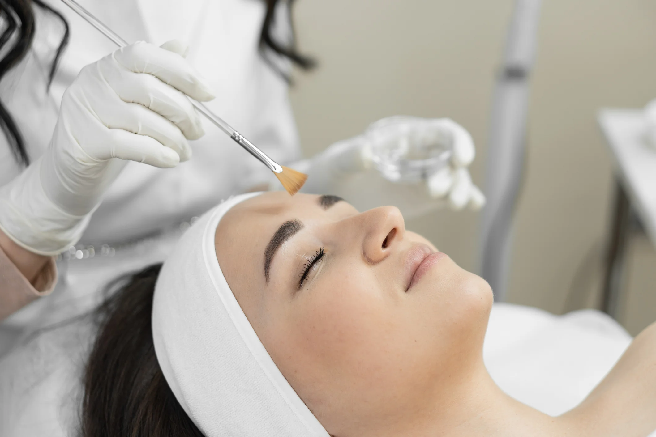 Chemical Peels