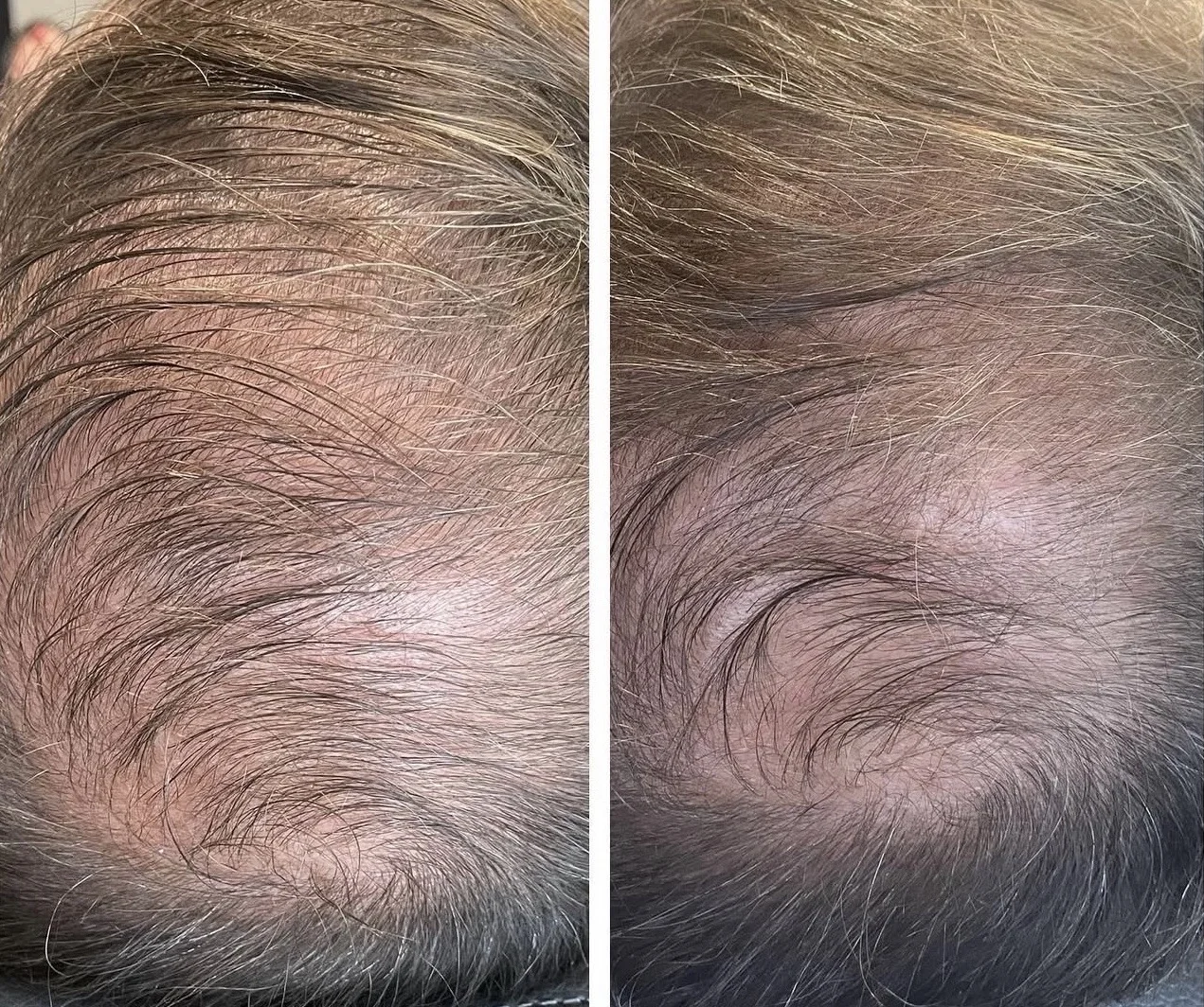 Cellenis Before & After